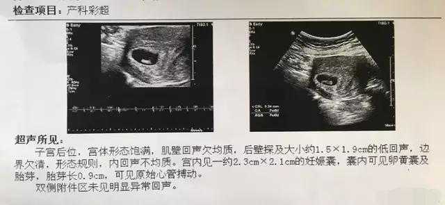 北京供卵试管在中国合法吗_怀孕50天左右彩超单上写什么？这个男孩彩超单，